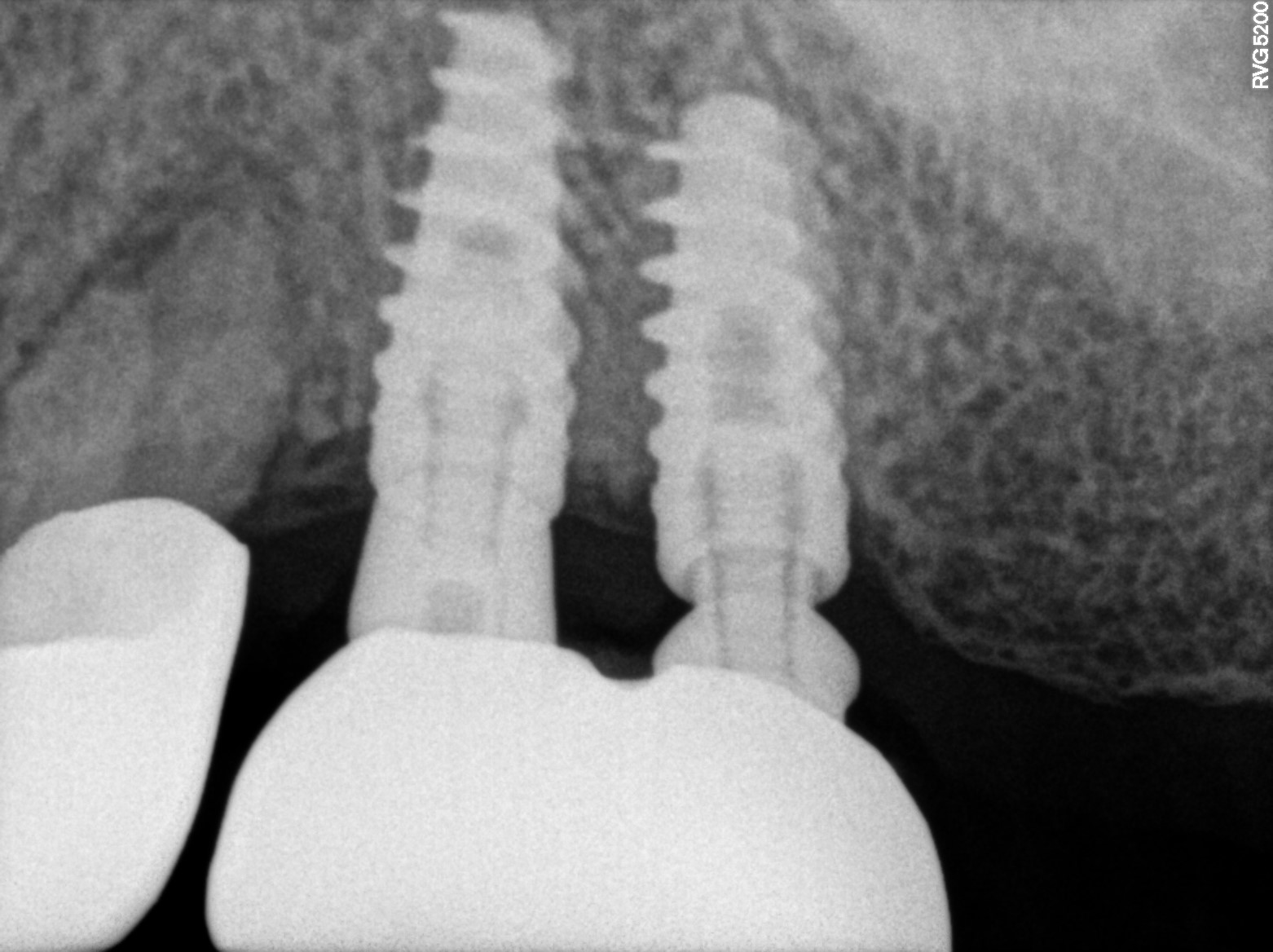 Dental X-ray